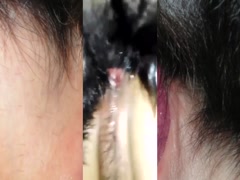 Thumb 9