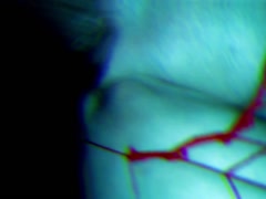Thumb 14