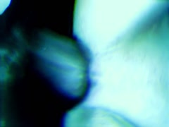 Thumb 15