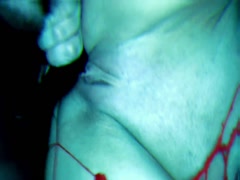 Thumb 17