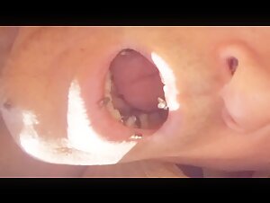 Thumb 6