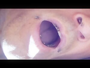 Thumb 8